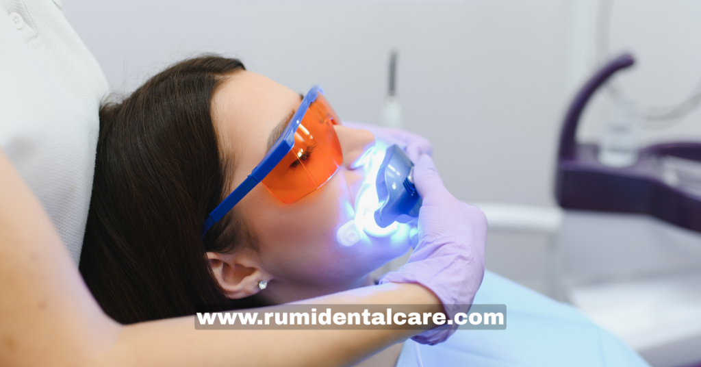 Teeth Whitening Procedure / دانت سفید کرنے کا عمل