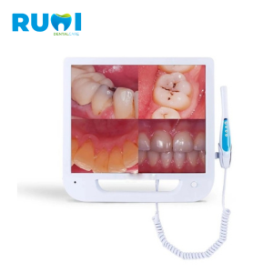 APPLE intraoral camera with screen and TFT clamp for dental imaging